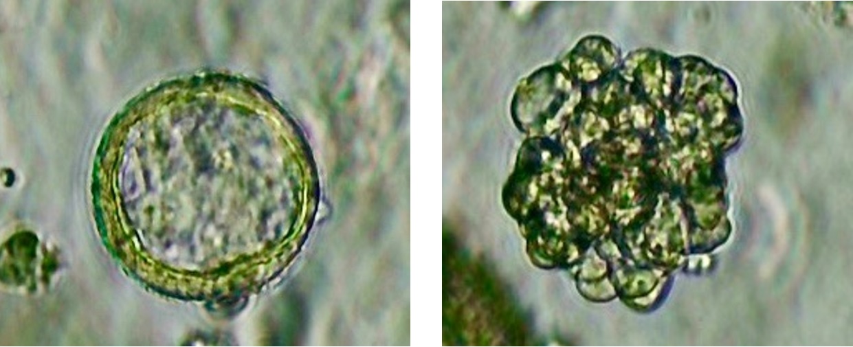 het effect van microplastics wordt getest op luchtpijp en longblaasjes gekweekt uit stamcellen.